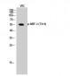 MEF-2 (phospho Thr319) Polyclonal Antibody