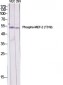 MEF-2 (phospho Thr319) Polyclonal Antibody