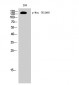 Neu (phospho Tyr1248) Polyclonal Antibody