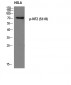 NF2 (phospho Ser518) Polyclonal Antibody