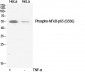NFκB-p65 (phospho Ser536) Polyclonal Antibody