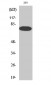 NFκB-p65 (phospho Thr254) Polyclonal Antibody