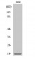 Op18 (phospho Ser25) Polyclonal Antibody