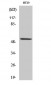 p53 (phospho Ser15) Polyclonal Antibody