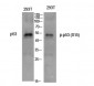 p53 (phospho Ser15) Polyclonal Antibody