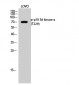 p70 S6 kinase α (phospho Thr229) Polyclonal Antibody