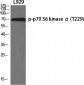 p70 S6 kinase α (phospho Thr229) Polyclonal Antibody
