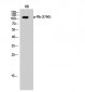 Rb (phospho Ser780) Polyclonal Antibody