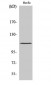 Rb (phospho Ser807) Polyclonal Antibody