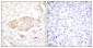 SGK1 (phospho Ser422) Polyclonal Antibody