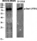 Stat1 (phospho Tyr701) Polyclonal Antibody