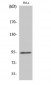 Stat6 (phospho Tyr641) Polyclonal Antibody