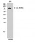 Tau (phospho Ser356) Polyclonal Antibody