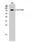 Tau (phospho Ser396) Polyclonal Antibody