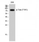 Tau (phospho Thr181) Polyclonal Antibody