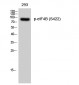 eIF4B (phospho Ser422) Polyclonal Antibody