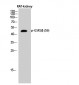 GSK3β (phospho Ser9) Polyclonal Antibody