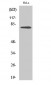 Btk (phospho Tyr551) Polyclonal Antibody