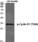 Cyclin D1 (phospho Thr286) Polyclonal Antibody