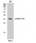 IκB-β (phospho Thr19) Polyclonal Antibody