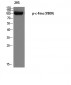 c-Fms (phospho Tyr809) Polyclonal Antibody