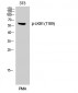 LKB1 (phospho Thr189) Polyclonal Antibody