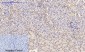 p38 (phospho Thr180/Y182) Polyclonal Antibody