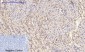 p38 (phospho Thr180/Y182) Polyclonal Antibody