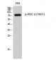 PKC α (phospho Tyr657) Polyclonal Antibody