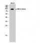 PKD2 (phospho Ser876) Polyclonal Antibody