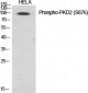 PKD2 (phospho Ser876) Polyclonal Antibody