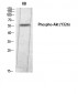 Akt (phospho Tyr326) Polyclonal Antibody