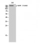 EGFR (phospho Tyr1069) Polyclonal Antibody