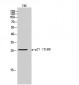 p27 (phospho Thr198) Polyclonal Antibody