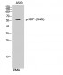 HBP1 (phospho Ser402) Polyclonal Antibody