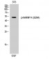hnRNP K (phospho Ser284) Polyclonal Antibody