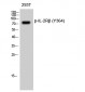 IL-2Rβ (phospho Tyr364) Polyclonal Antibody