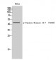 Casein Kinase IIα (phospho Tyr255) Polyclonal Antibody