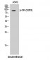 GR (phospho Ser203) Polyclonal Antibody