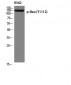 Neu (phospho Tyr1112) Polyclonal Antibody