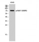 Raf-1 (phospho Ser301) Polyclonal Antibody
