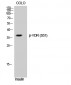 VDR (phospho Ser51) Polyclonal Antibody