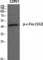 c-Fos (phospho Ser32) Polyclonal Antibody