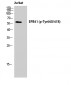 4.1R (phospho Tyr660) Polyclonal Antibody