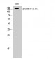 ErbB-3 (phospho Tyr1197) Polyclonal Antibody