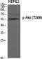 Akt (phospho Thr308) Polyclonal Antibody