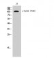 EphA4 (phospho Tyr596) Polyclonal Antibody