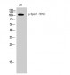 EphA7 (phospho Tyr791) Polyclonal Antibody