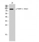 FGFR-4 (phospho Tyr642) Polyclonal Antibody