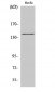 NOS3 (phospho Ser1177) Polyclonal Antibody